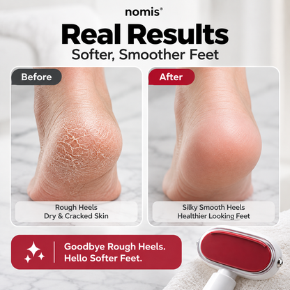 Dual-Sided Foot Callus Remover